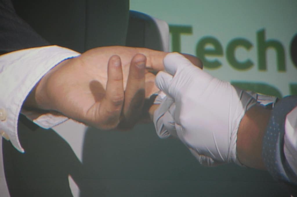 doctor drawing blood sample from a finger