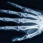 X-Ray Shoe Fitting Machines