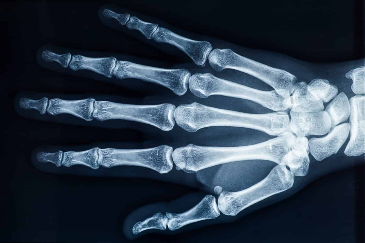 X-Ray Shoe Fitting Machines