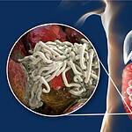 Tapeworm Diets