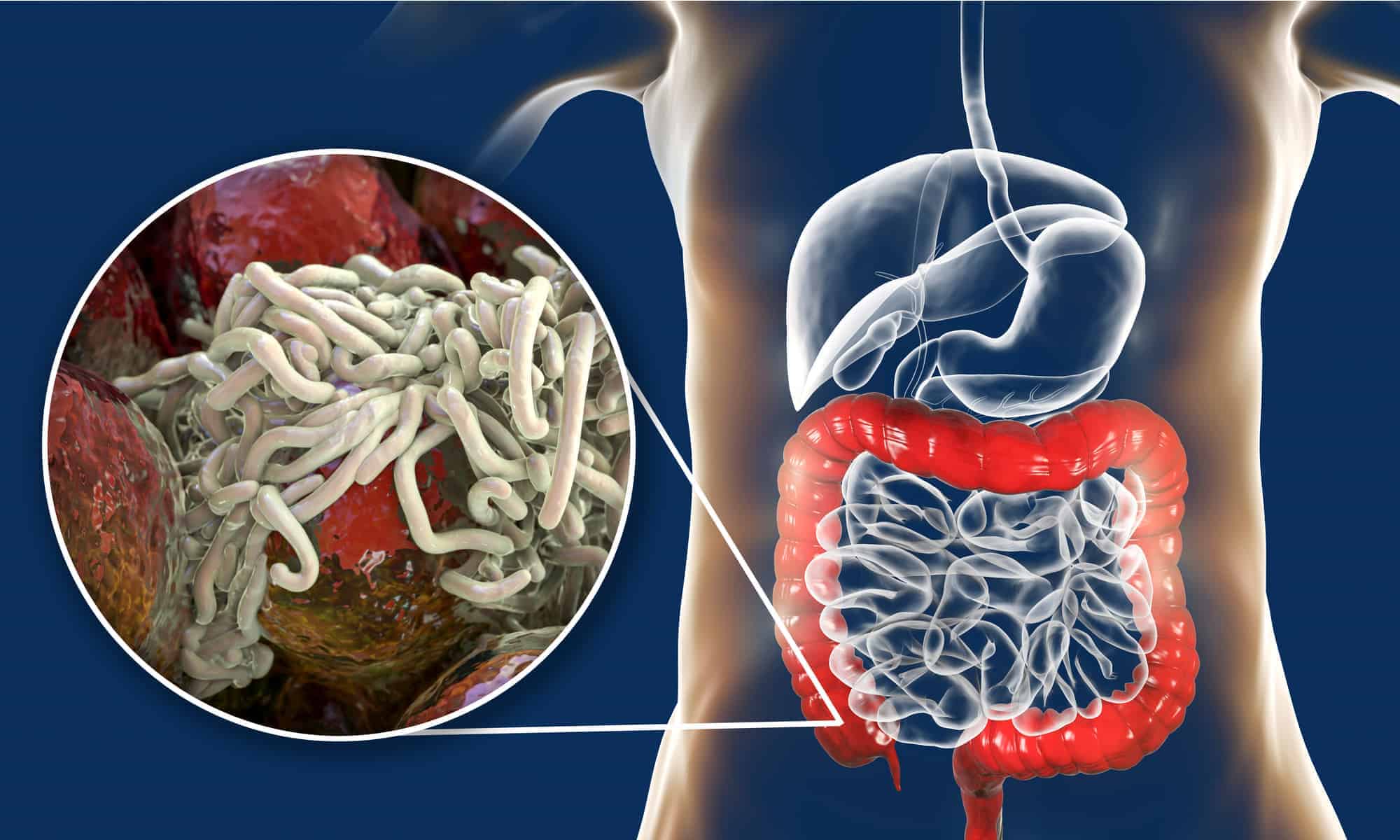 Tapeworm Diets